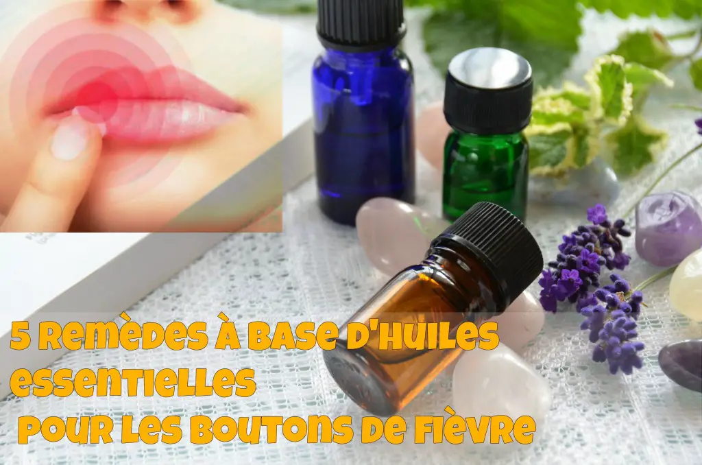 Boutons de Fièvre : 5 Remèdes à base D'huiles Essentielles Pour Les Enlever