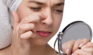 photo : points blancs de votre visage